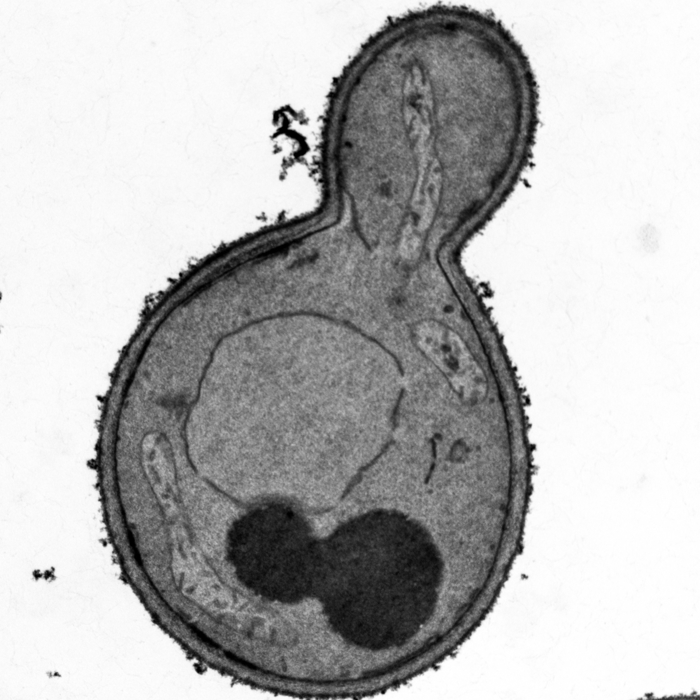 Microwave-assisted preparation of yeast cells for ultrastructural analysis by electron microscopy