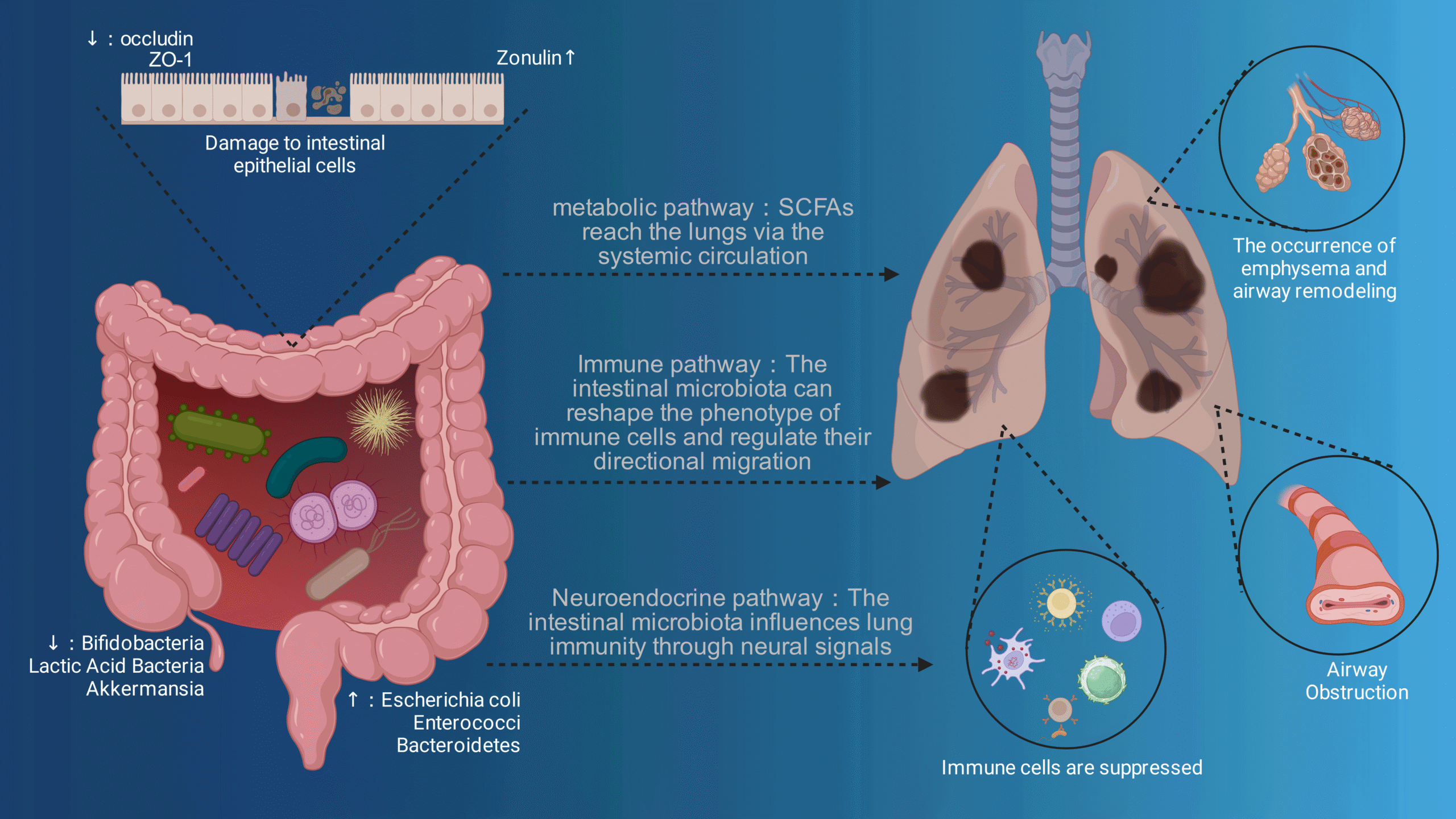 From the gut to the lungs: The role of gut microbiota in chronic obstructive pulmonary disease and related research progress